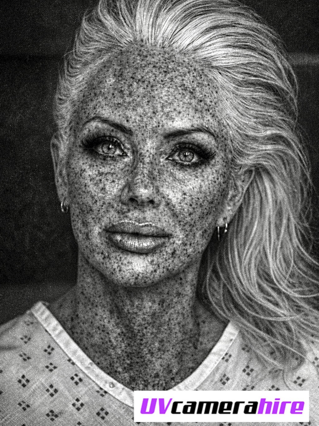 UV Camera Sun and Sunbed Sun Damage Karrieann McDonnell